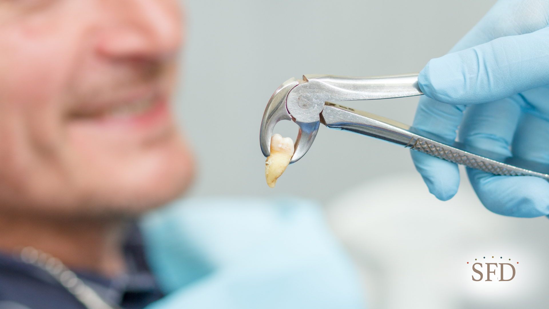 A dentist is removing a tooth from a patient 's mouth with a pair of pliers.