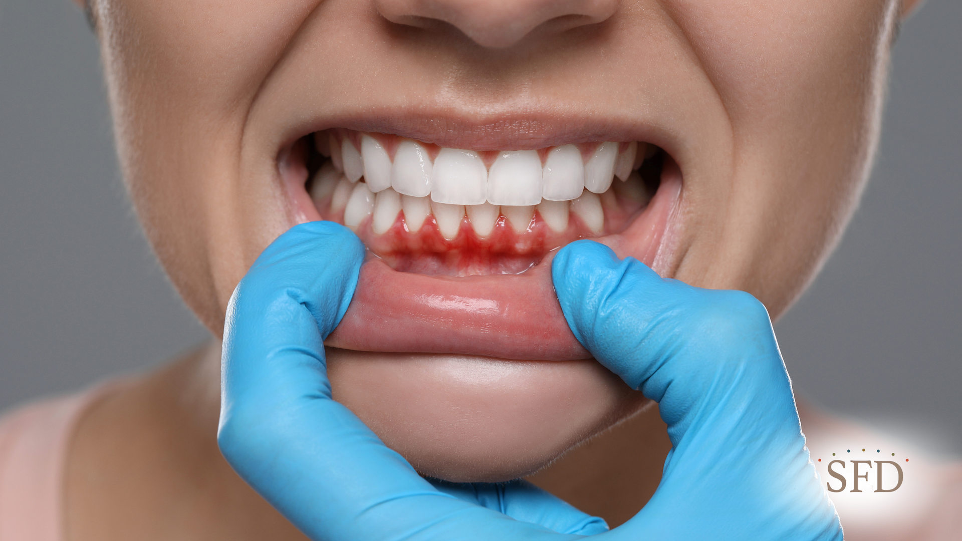 A woman is getting her teeth examined by a dentist.