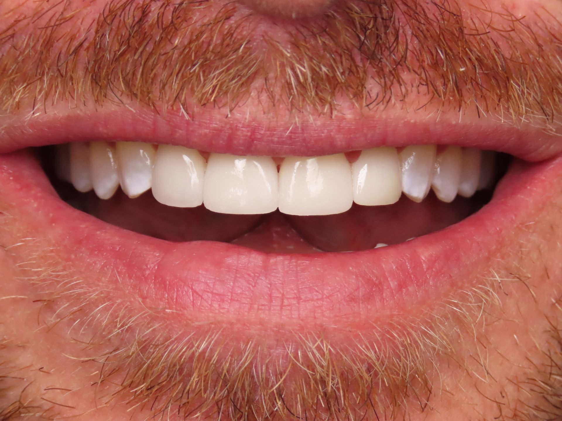 A close up of a man 's mouth with a beard and white teeth.
