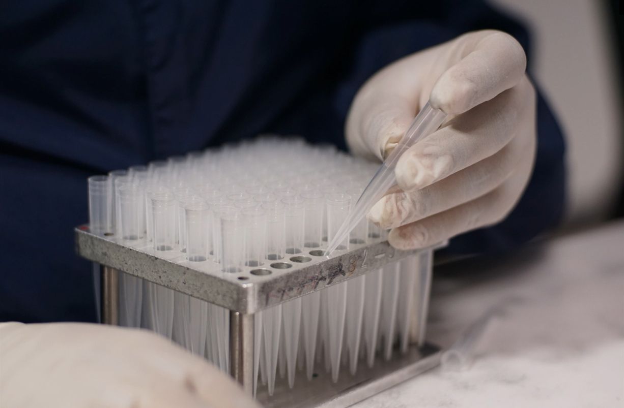 A person is holding a pipettes