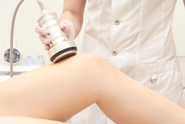 RF Leg Treatment — Advanced Cosmetic & Beauty Clinic in Bundaberg South, QLD