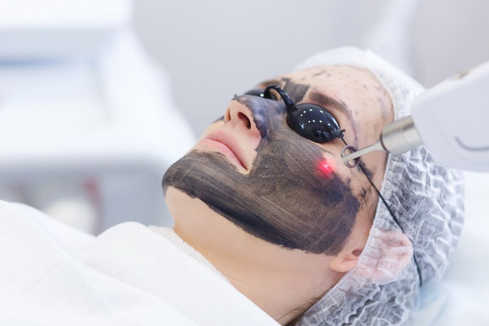 Woman is Getting a Laser Treatment on Her Face — Advanced Cosmetic & Beauty Clinic in Bundaberg South, QLD