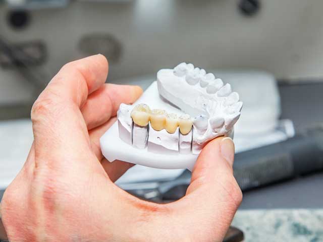 A person is holding a model of a dental bridge in their hand.