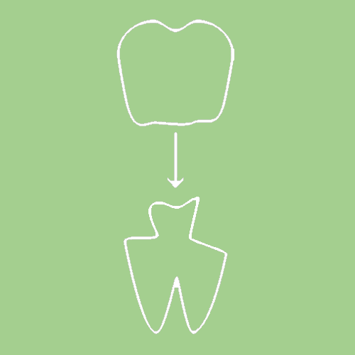 Dental Crowns and Bridges | Cosmetic Dentist Endicott