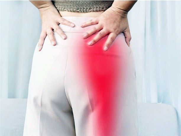 Woman affected by sciatica - radiating nerve pain