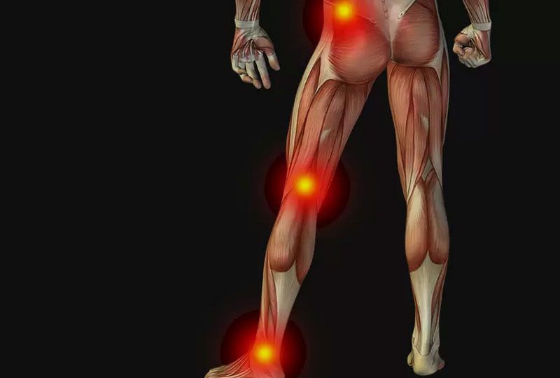 Human body with radiating nerve pain