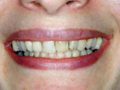A close up of a woman 's smile 