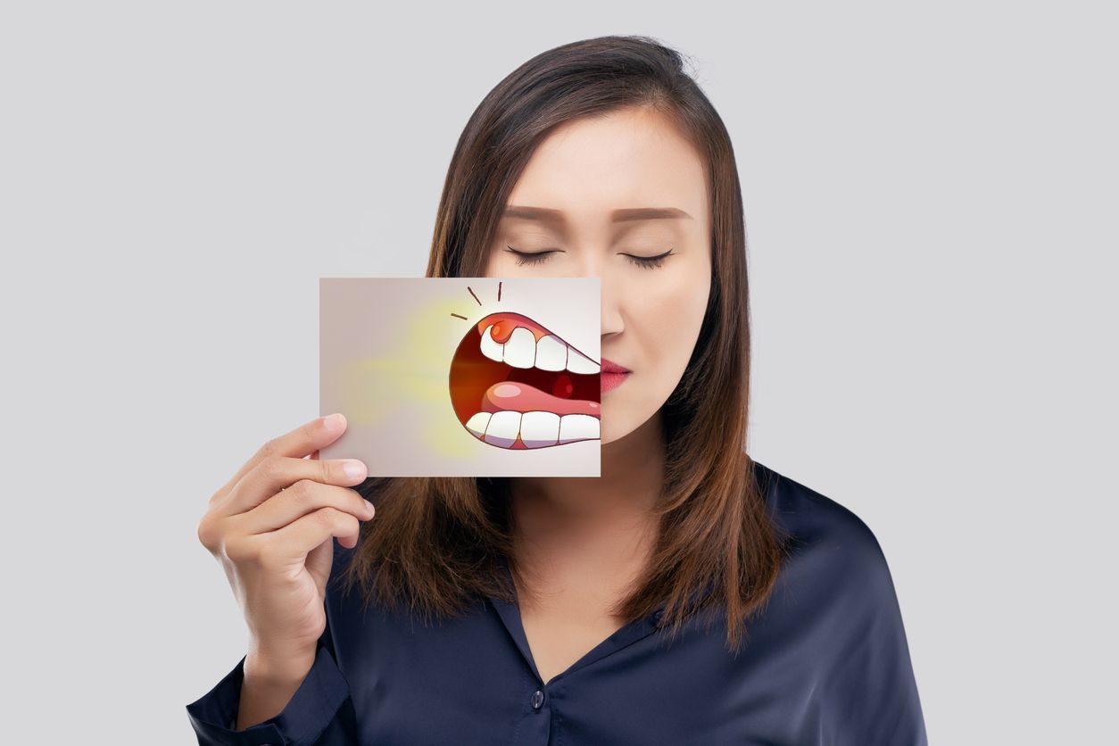 A woman is holding a picture of her teeth in front of her face.