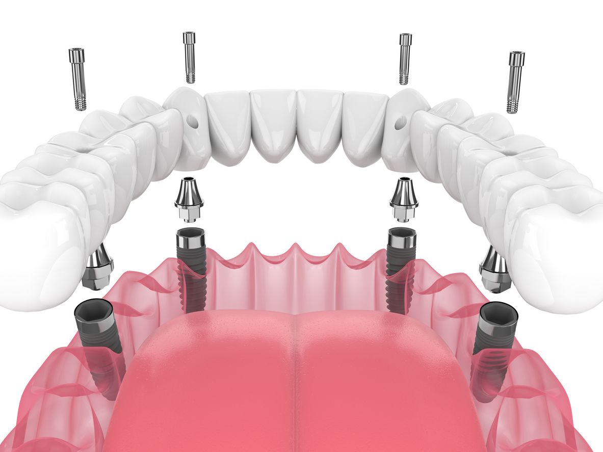 A close up of a person 's teeth and lips.