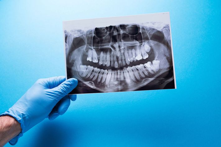 panoramica rx dentale