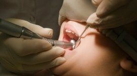 intervento odontoiatrico