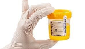 LABORATORIO DE ANÁLISIS CLÍNICOS ÁNGELES