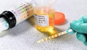 LABORATORIO DE ANÁLISIS CLÍNICOS ÁNGELES