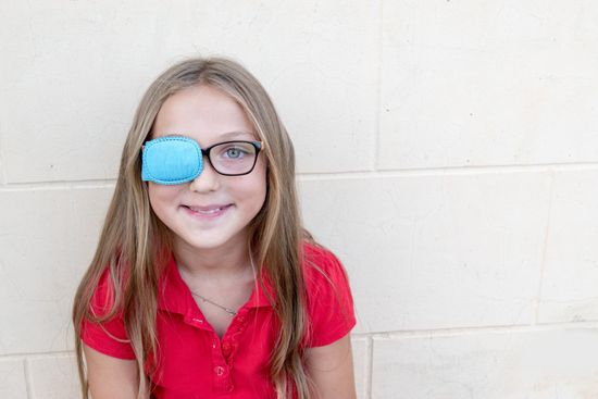 Bambina con protezione oculare in seguito a intervento oculistico