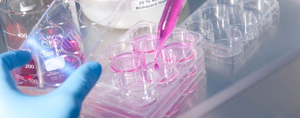 trattamenti odontoiatrici per lo sbiancamento dei denti