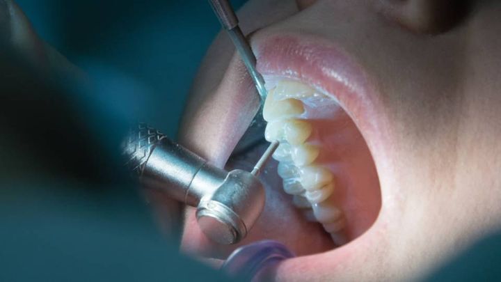 Trattamento di endodonzia e implantologia