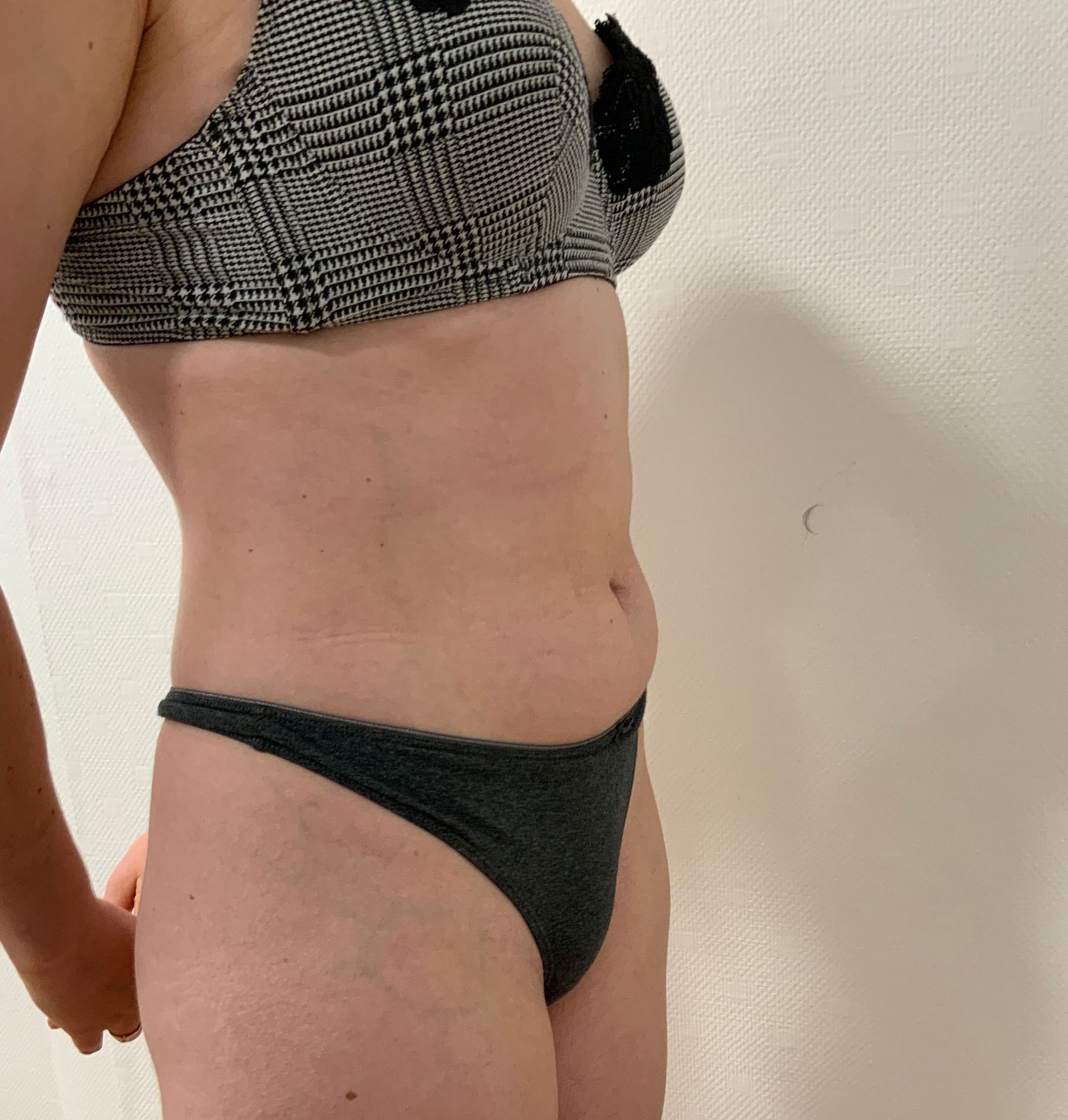 Femme en lingerie liposuccion du ventre après vue de profil