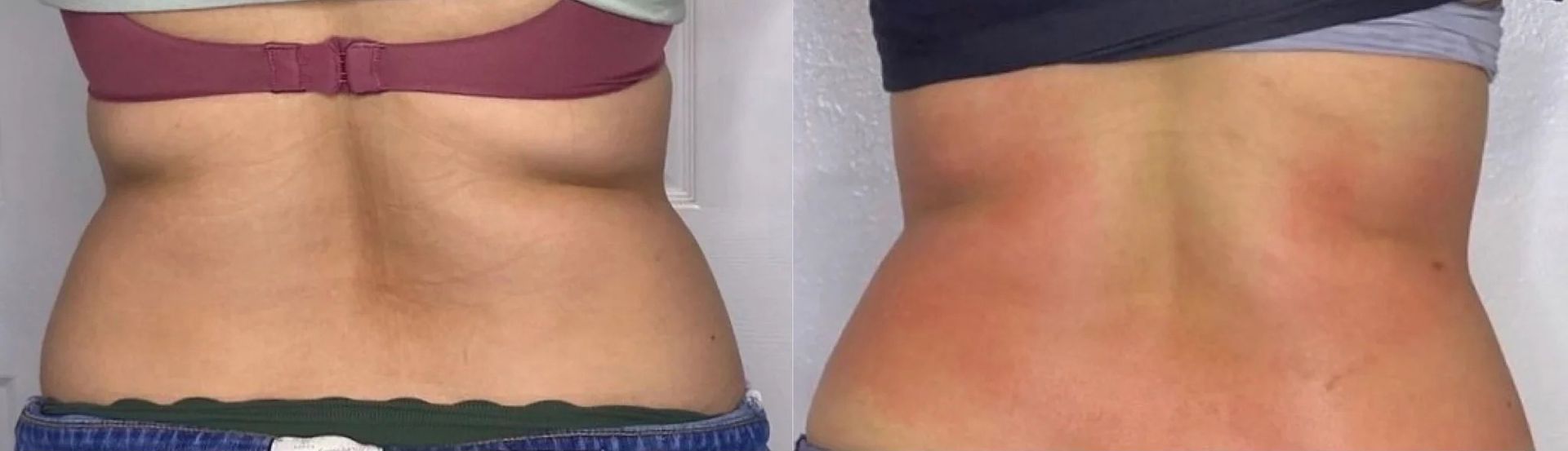 Back Before And After