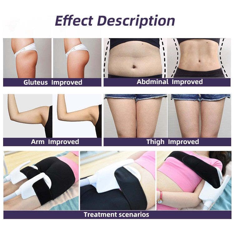 Before And After EMSculpt Procedure