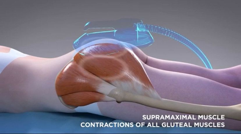 Surgical Body Sculpting