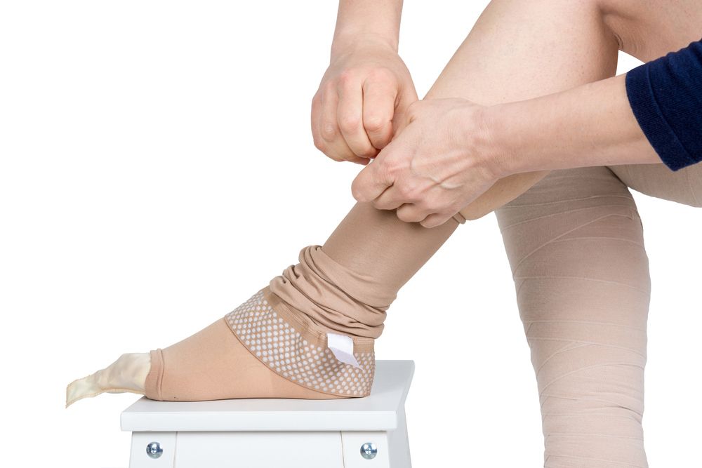 Treating Lymphoedema — Occupational Therapist in Yeppoon, QLD