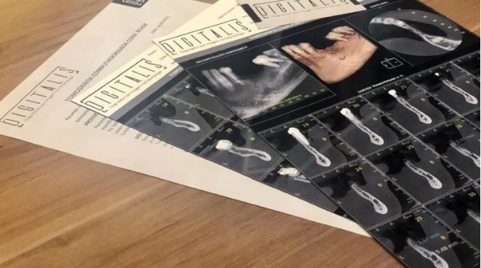 Neste artigo, você vai entender por que a imagem é a base de tudo — e como escolher o lugar certo
