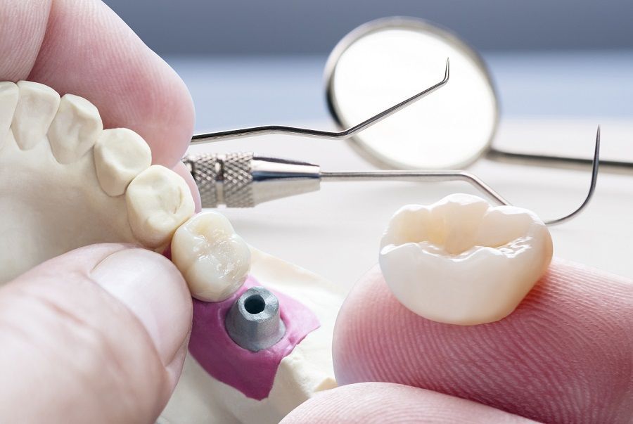 A person is holding a model of a tooth in their hand.