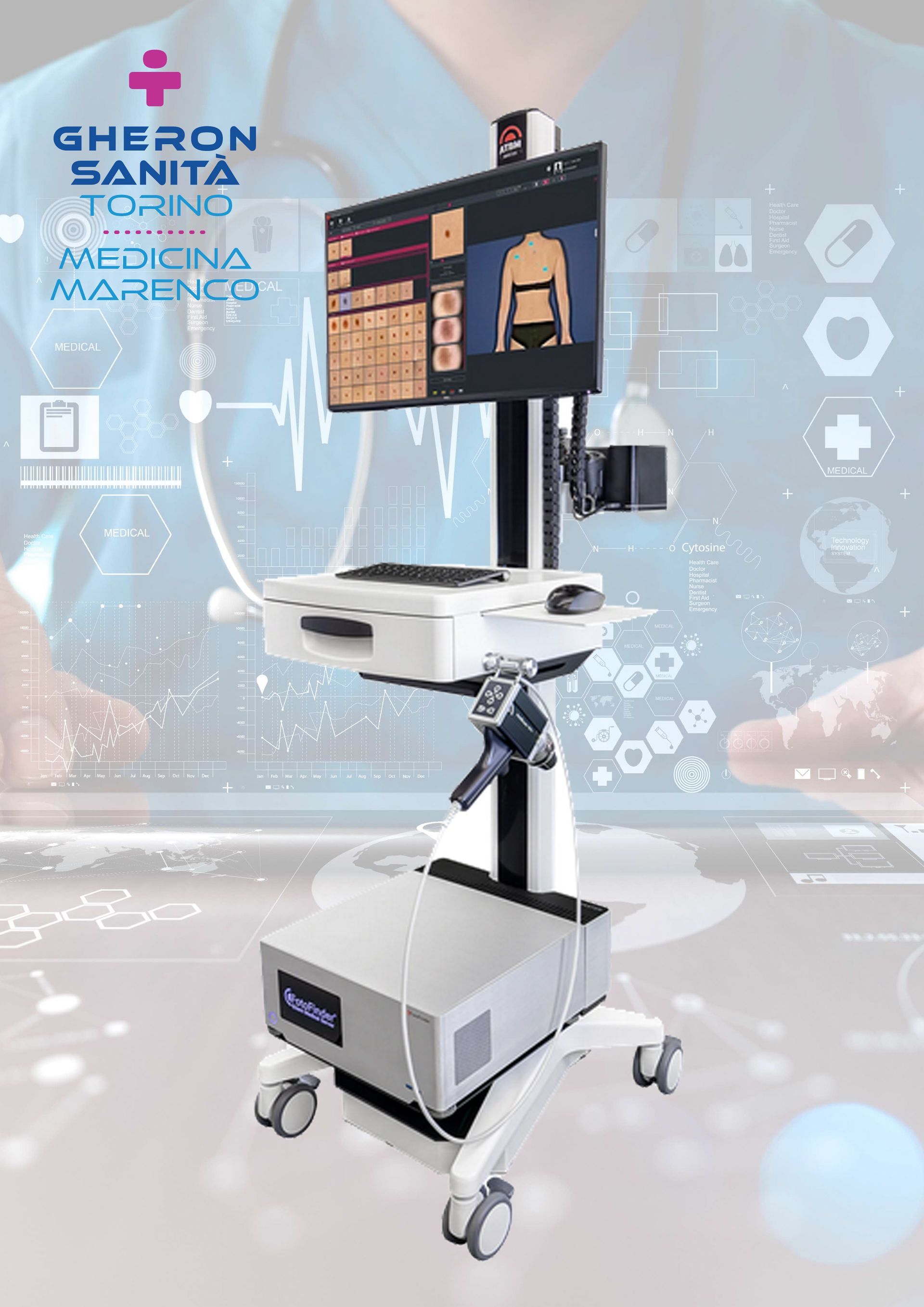 Mappatura nevi con Fotofinder