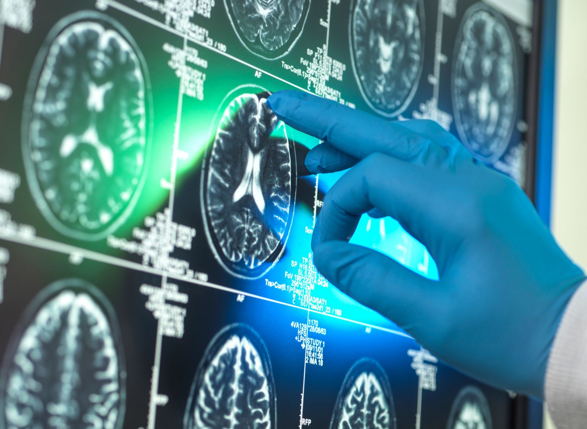 NEUROLOGIA