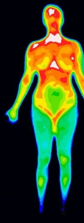 it's women x-ray image