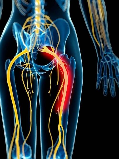 A computer generated image of a skeleton and nerves.