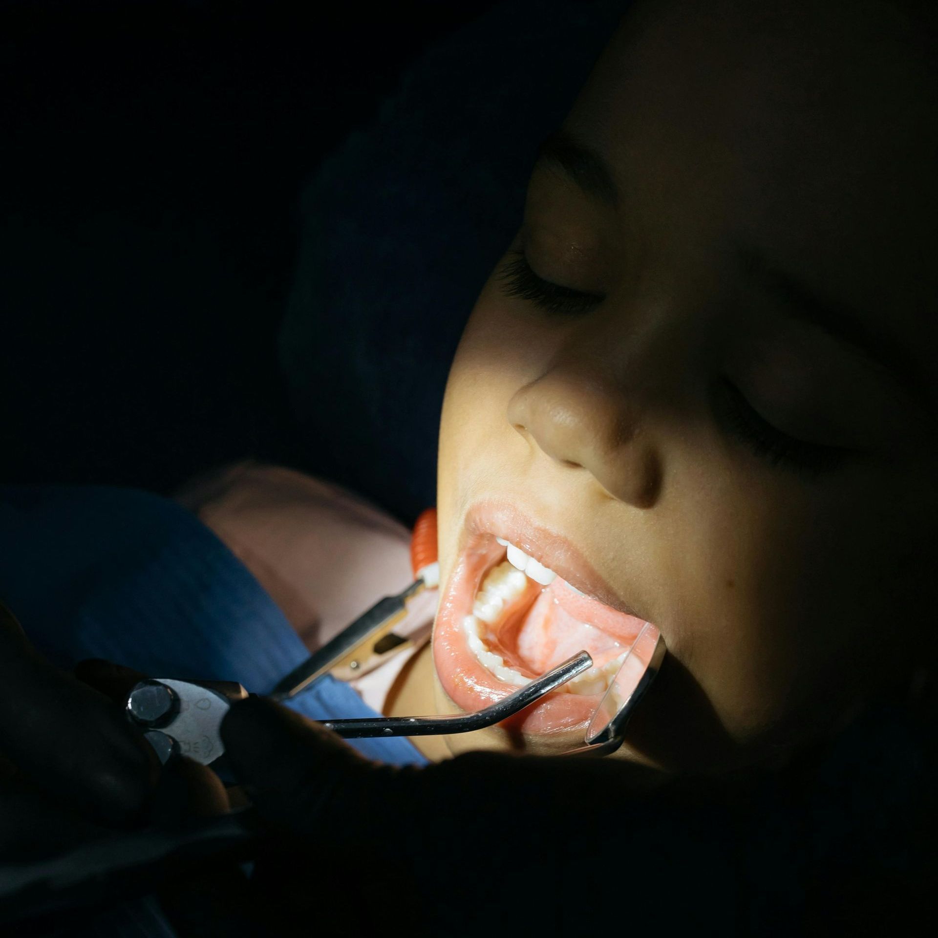 A woman is getting her teeth examined by a dentist