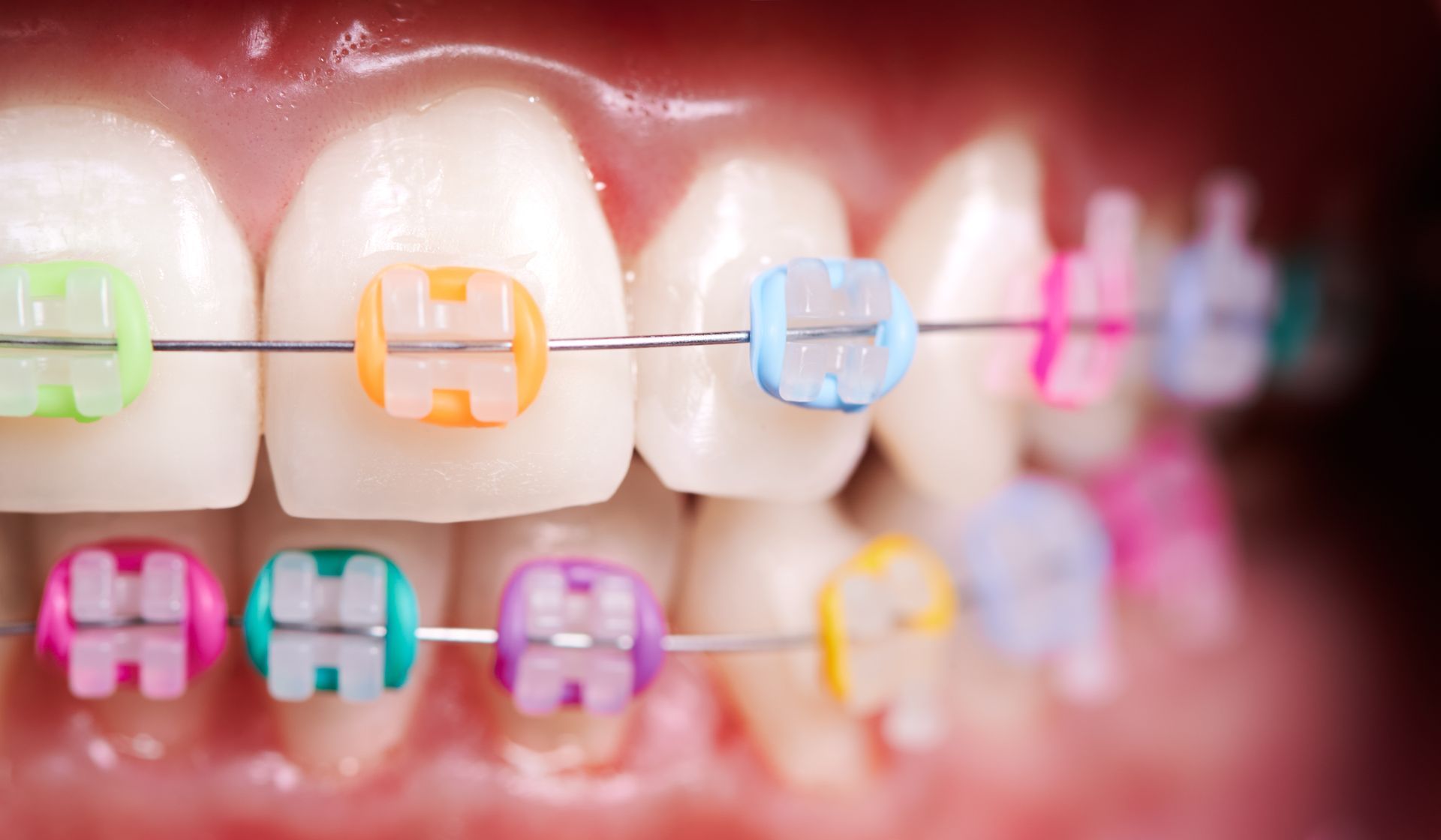 Orthodontic Services in Amarillo, TX