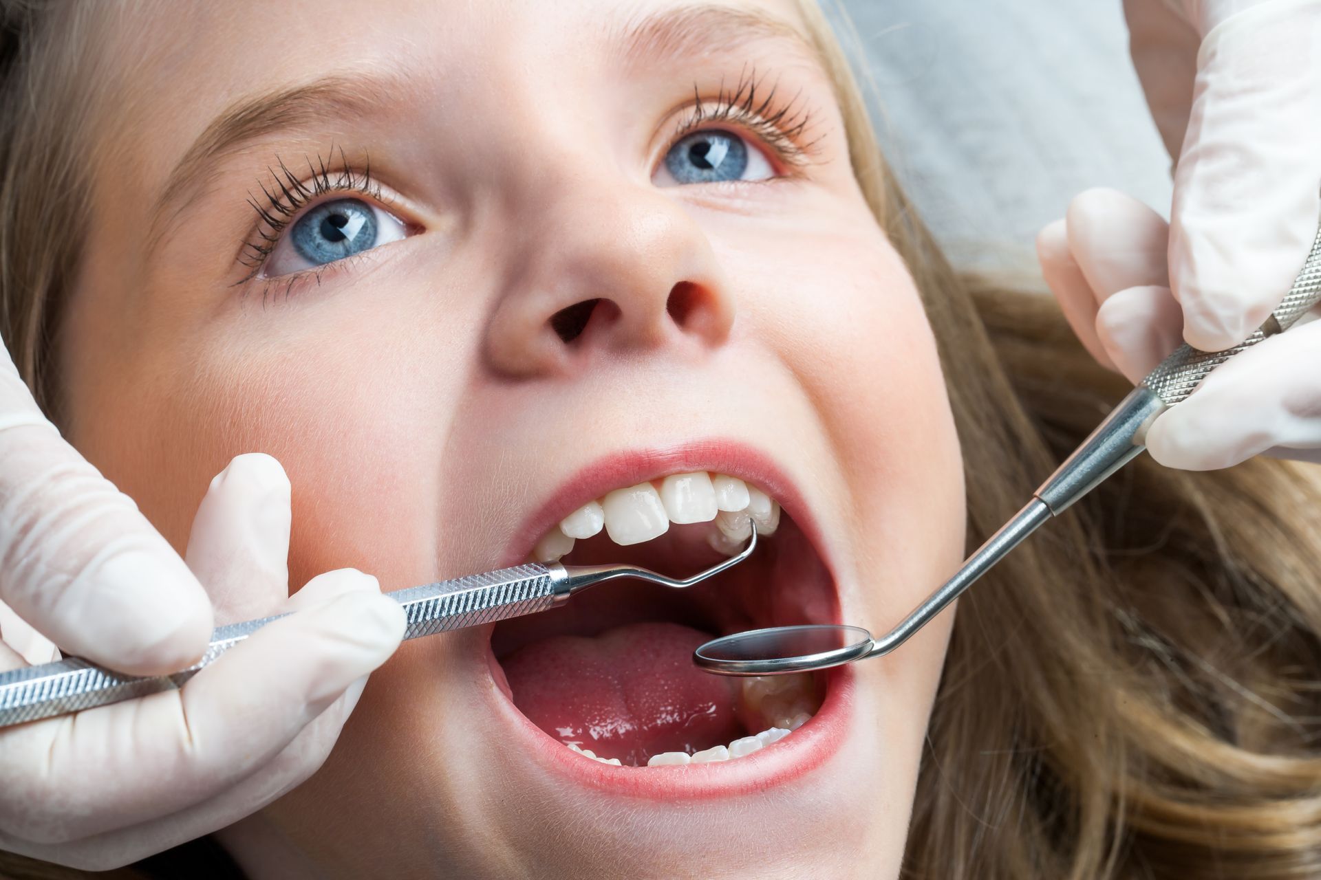 Pediatric Dental Crowns in Amarillo, TX