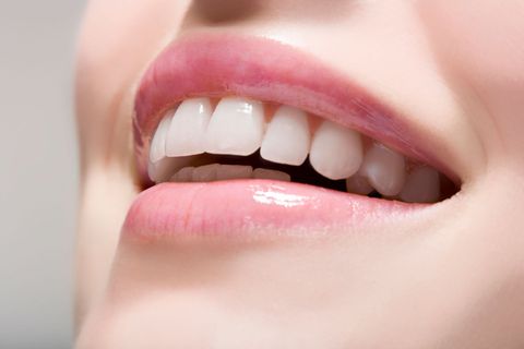Teeth Whitening — Asheville NC — Asheville Aesthetic Dental Partners