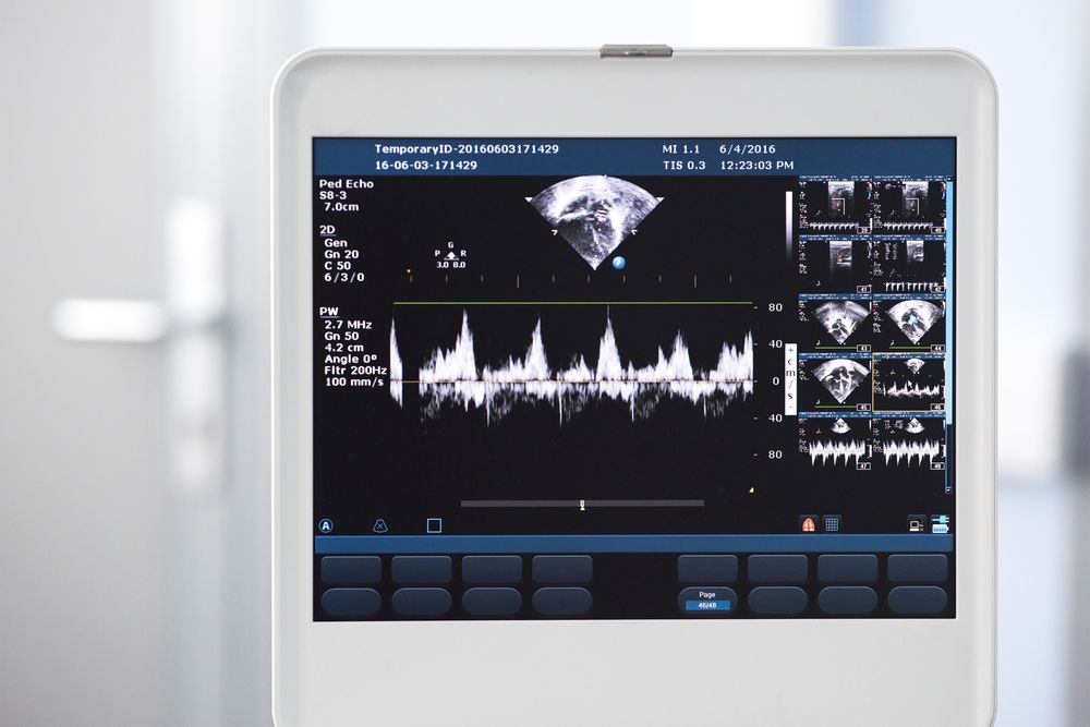 Ultrasound machine displaying heart scan with waveform data.