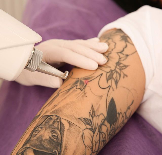 This urgent care has Botox, tattoo removal, too