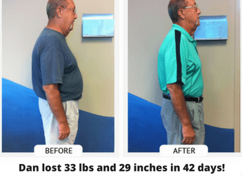 Chirothin weight loss program for Chiropractors. Lose 25 - 30 pounds in 42 days