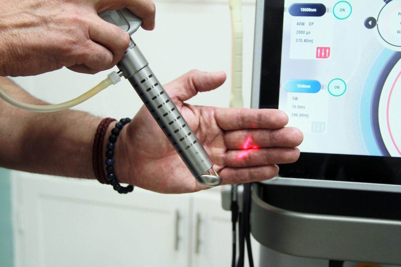 Persona con un dispositivo láser apuntando con una luz roja a la palma de la mano. Al fondo, una máquina con una pantalla.