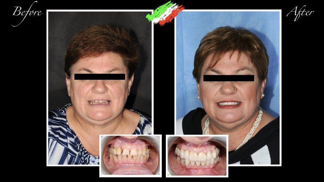 Ricostruzione e sbiancamento dentale