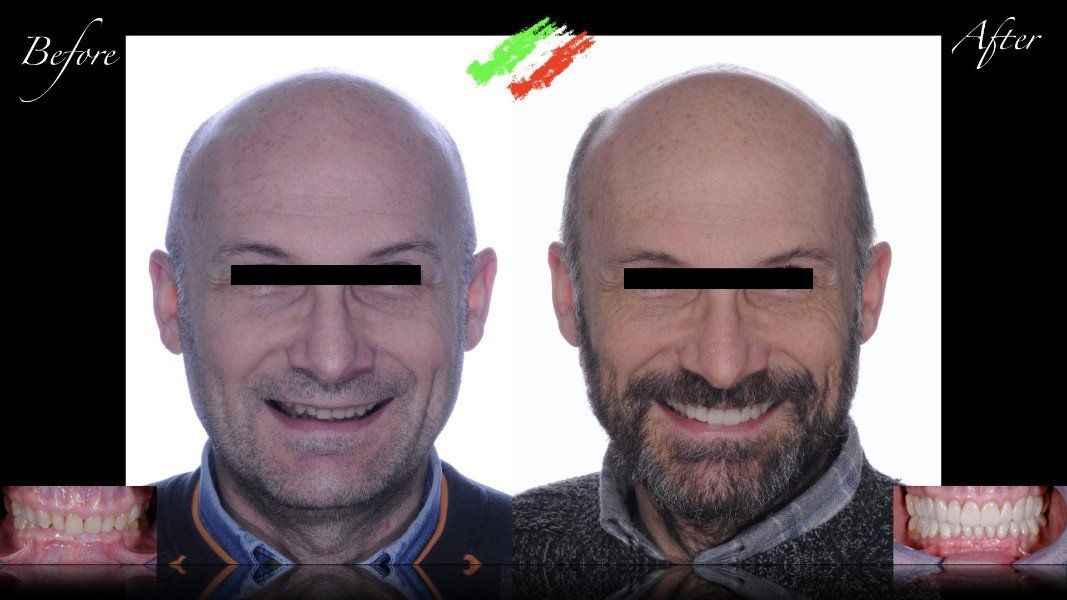 Ricostruzione dentale