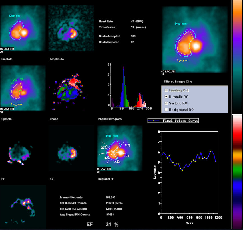 A computer screen shows a bunch of images and graphs