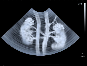 A x-ray of a kidney and a few branches