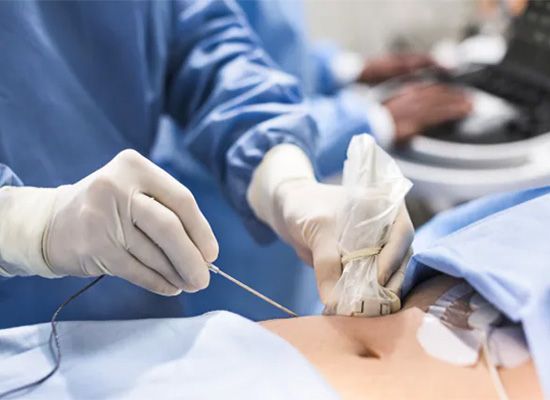 A surgeon is performing surgery on a patient 's stomach.