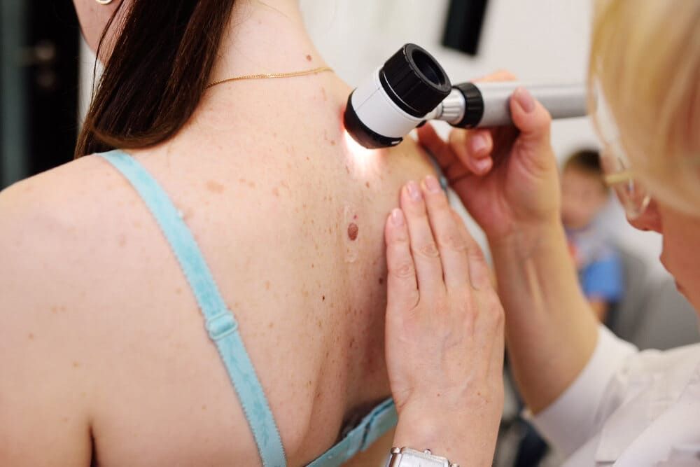 A Doctor Is Examining A Woman 's Back With A Magnifying Glass — Health Hub Mackay In Nebo, QLD