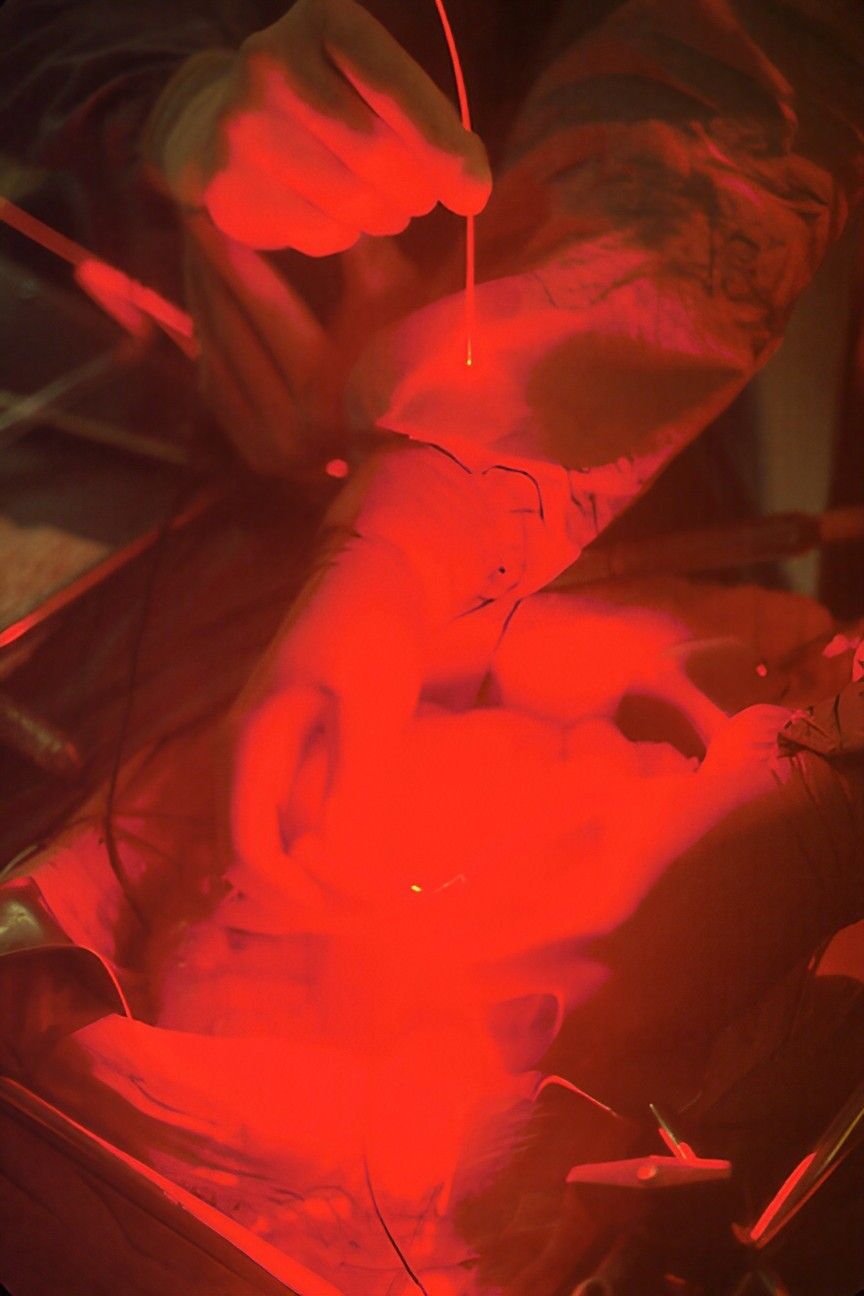 A Red Light Is Shining On A Person 's Arm — Health Hub Mackay in Mackay, QLD