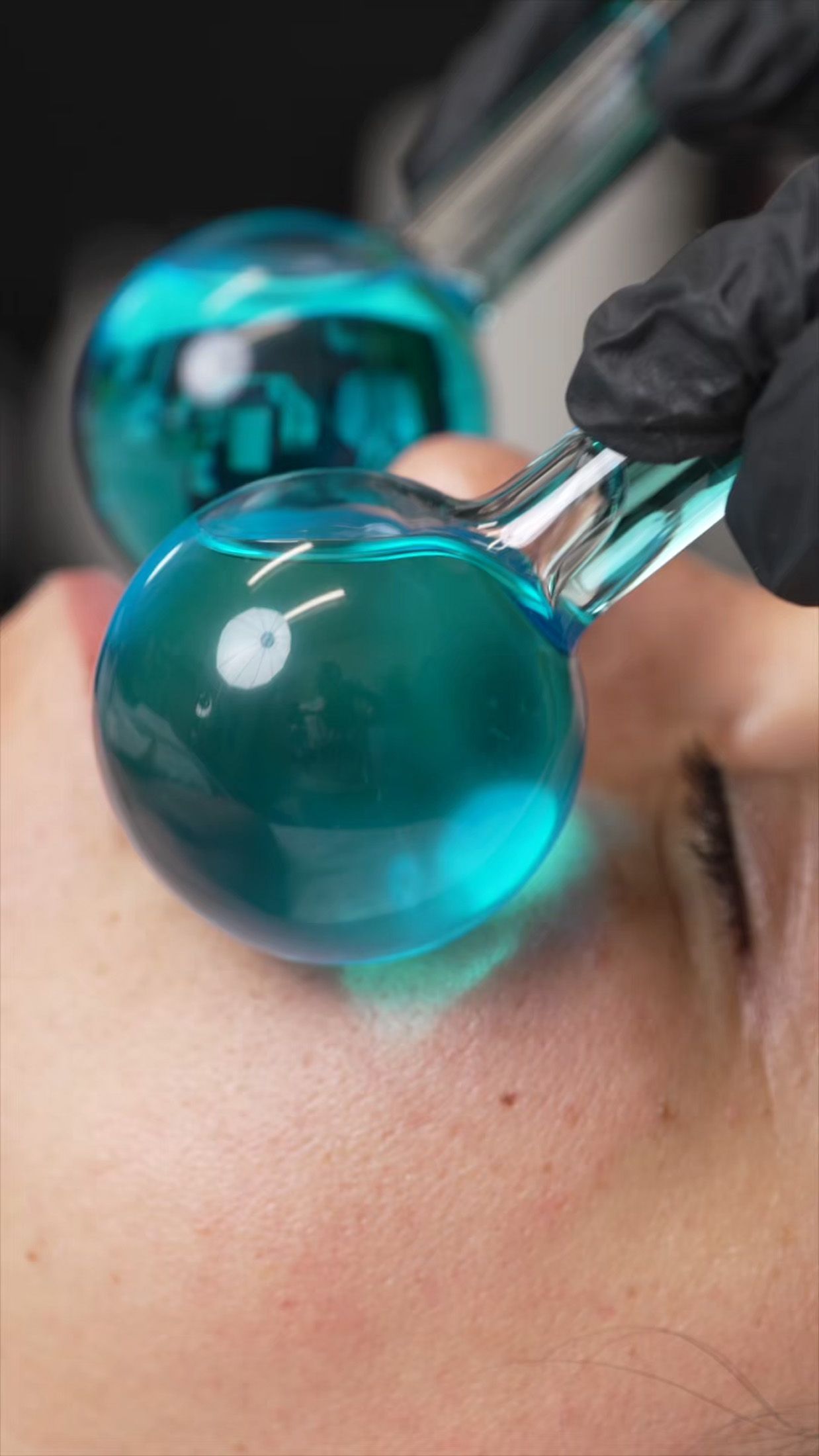 Person receiving facial massage with blue liquid-filled globes held by black-gloved hands.