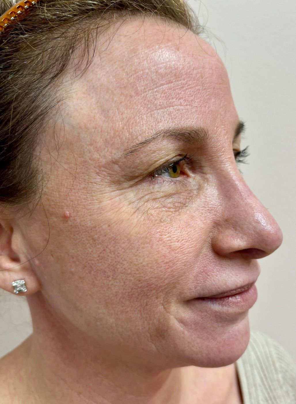 A close up of a woman 's face with no makeup on.