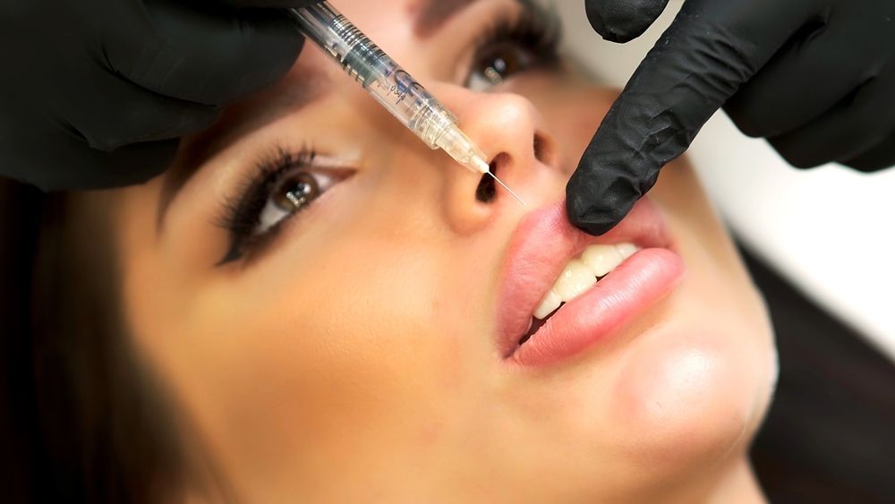 Best Lip Filler Specialist Rockville Maryland