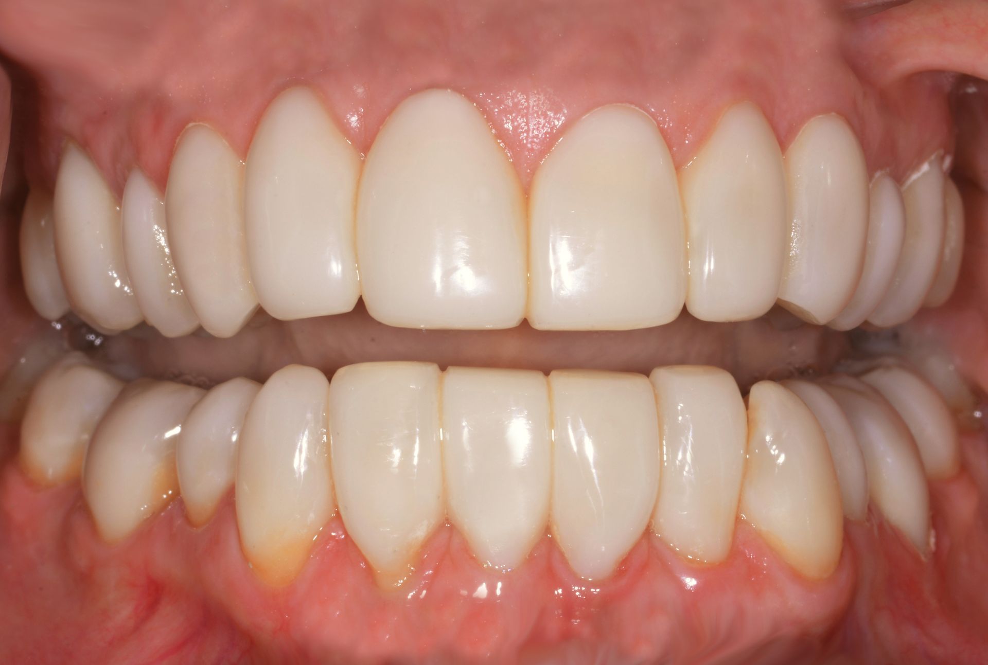 Close-up of a person's teeth. They are white and evenly spaced | Ogden, UT | Pleasant Valley